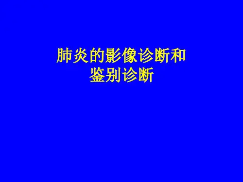 肺炎的影像诊断和鉴别诊断