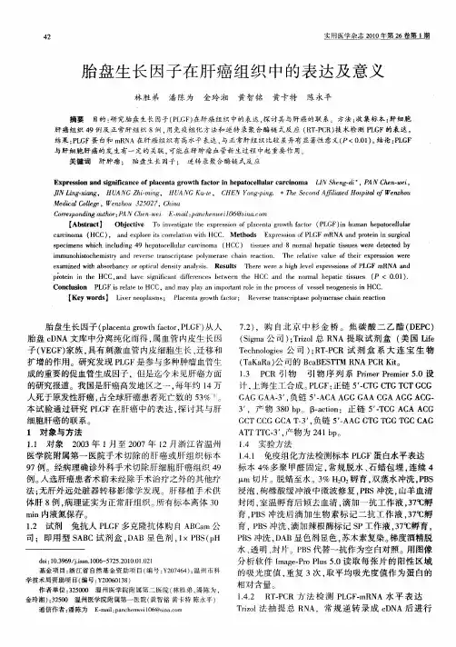 胎盘生长因子在肝癌组织中的表达及意义
