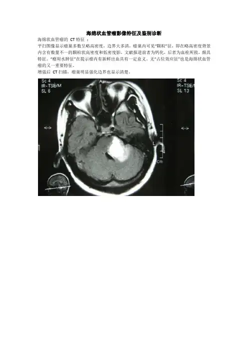 海绵状血管瘤影像特征及鉴别诊断