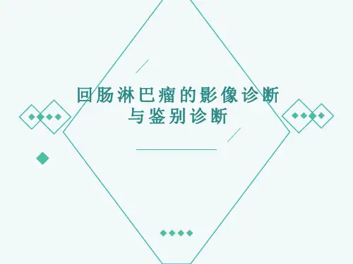 回肠淋巴瘤的影像诊断与鉴别诊断