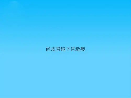 经皮胃镜下胃造瘘