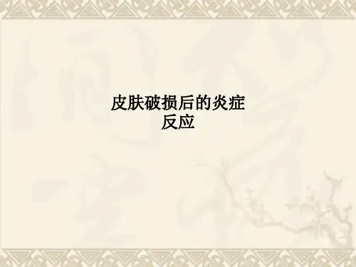 皮肤破损后的炎症反应PPT课件