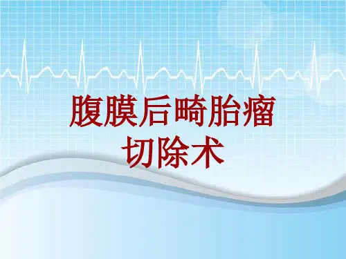 手术讲解模板:腹膜后畸胎瘤切除术