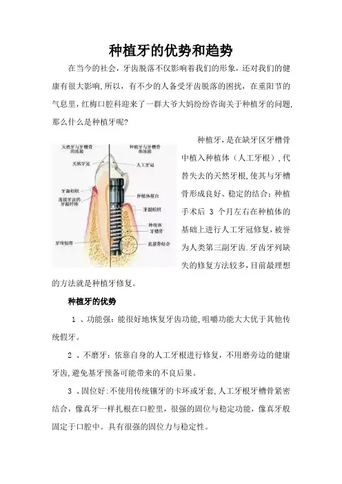 种植牙的优势和趋势