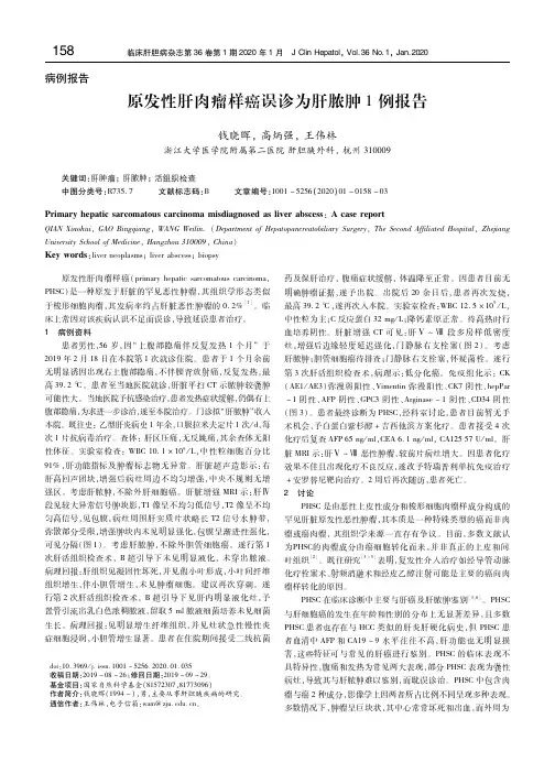 原发性肝肉瘤样癌误诊为肝脓肿1例报告 钱晓晖