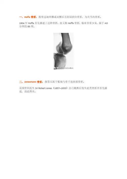 (仅供参考)33种特殊类型骨折