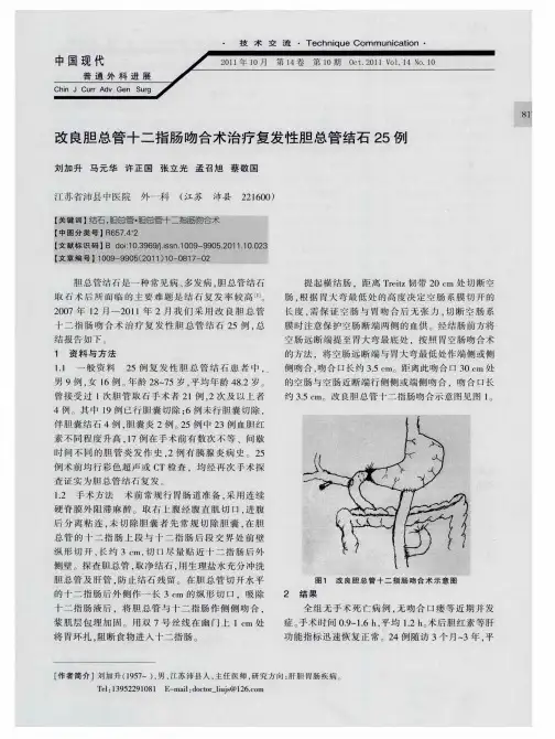 改良胆总管十二指肠吻合术治疗复发性胆总管结石25例