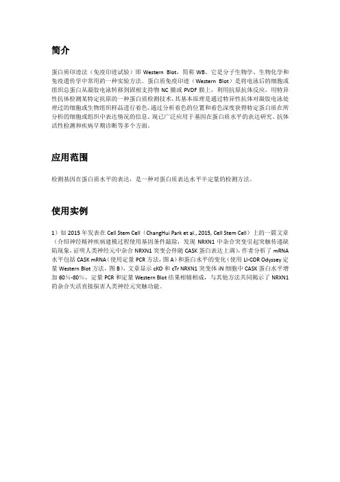 Western Blot 实验操作教程