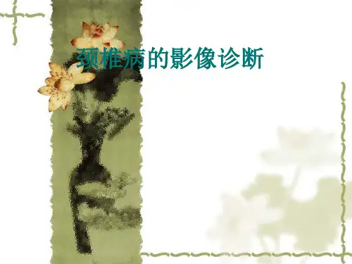 颈椎病的影像诊断