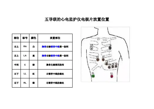 五导联的心电监护仪电极片放置位置 2