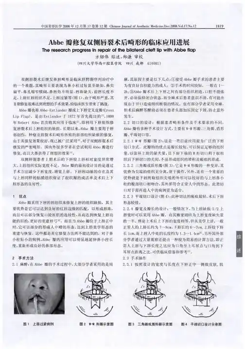Abbe瓣修复双侧唇裂术后畸形的临床应用进展