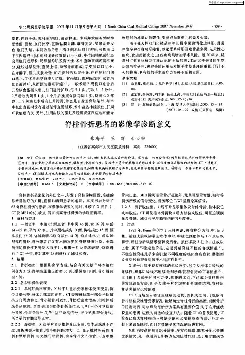 脊柱骨折患者的影像学诊断意义