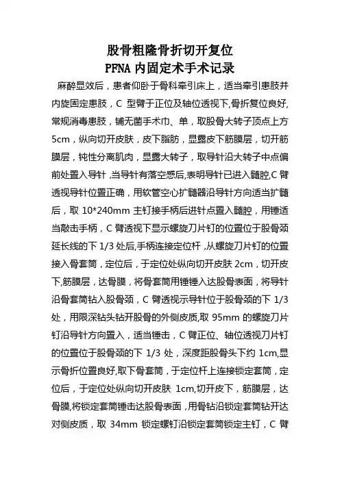 股骨粗隆骨折切开复位PFNA内固定术