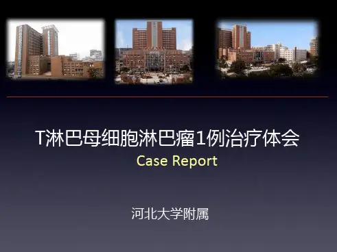 淋巴瘤病例讨论
