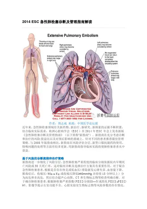 2014 ESC急性肺栓塞诊断及管理指南解读