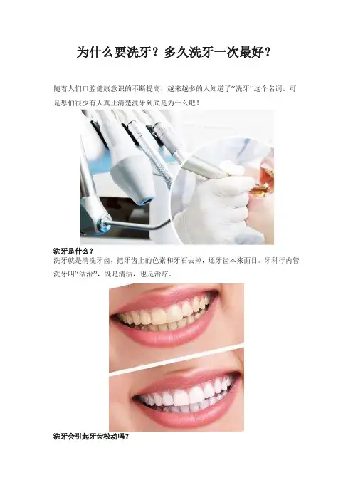 为什么要洗牙？多久洗牙一次最好？