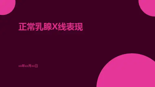 正常乳腺X线表现