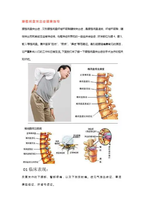 腰椎间盘突出症健康指导