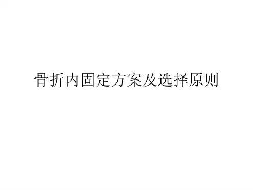 骨折内固定方案及选择原则