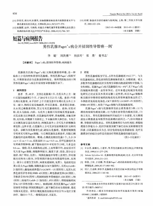 男性乳腺Paget’s病合并浸润性导管癌一例