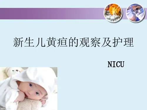 新生儿黄疸的观察及护理---PPT精品课件