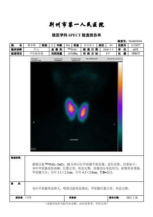 ECT报告模板
