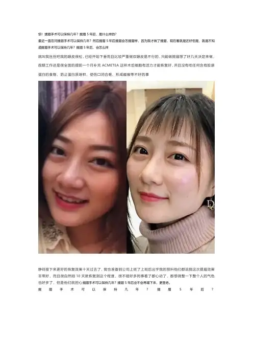 惊!提眉手术可以保持几年？提眉5年后,是什么样的？