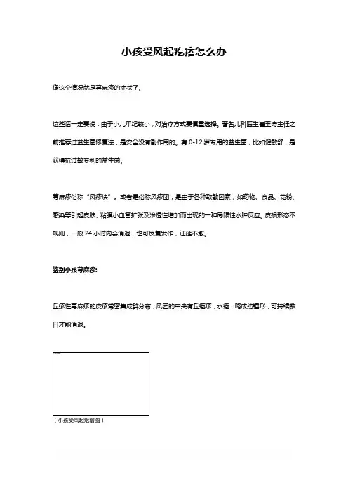 小孩受风起疙瘩怎么办