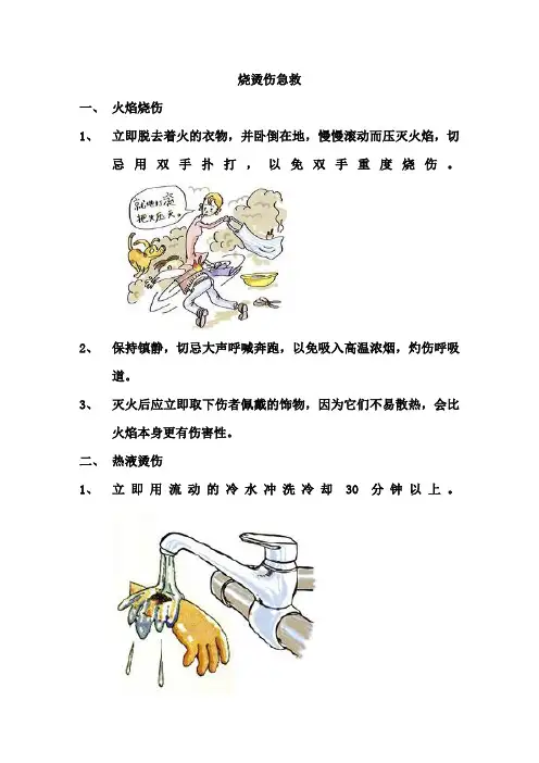 烧烫伤紧急处理宣教