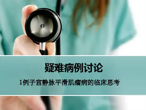 病例讨论静脉内平滑肌瘤