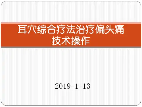 耳穴综合疗法治疗偏头痛技术操作