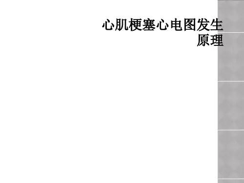心肌梗塞心电图发生原理