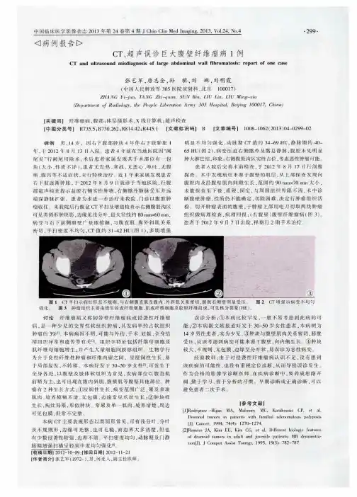 CT、超声误诊巨大腹壁纤维瘤病1例