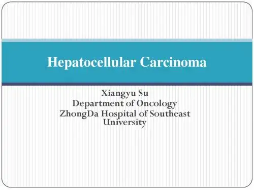 Hepatocellular Carcinoma
