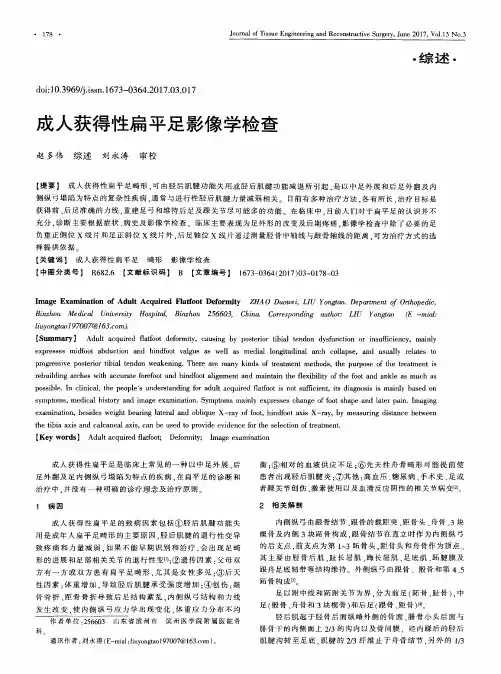 成人获得性扁平足影像学检查