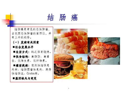 结肠癌ppt课件