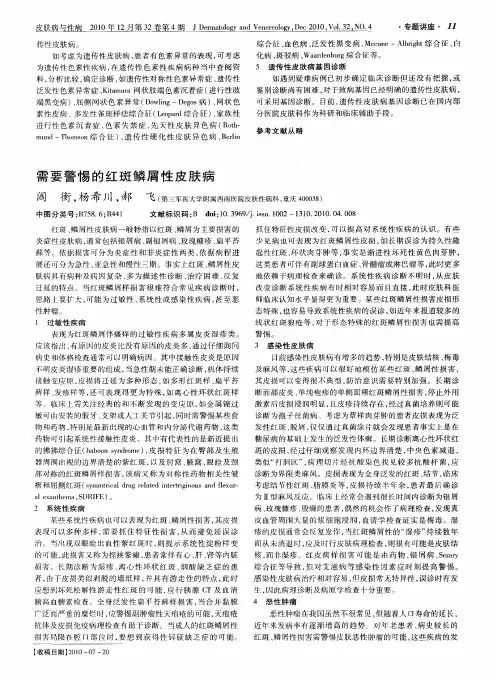 需要警惕的红斑鳞屑性皮肤病