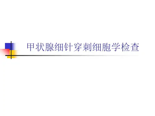 甲状腺细针穿刺细胞学检查 ppt课件