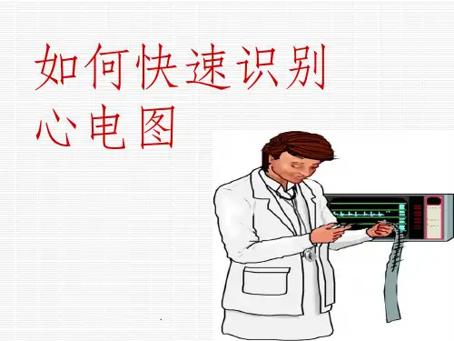 快速识别心电图(1)