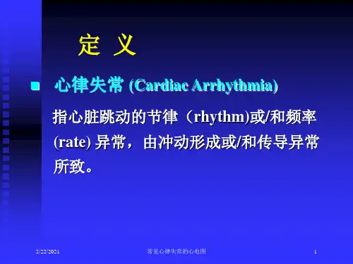常见心律失常的心电图课件