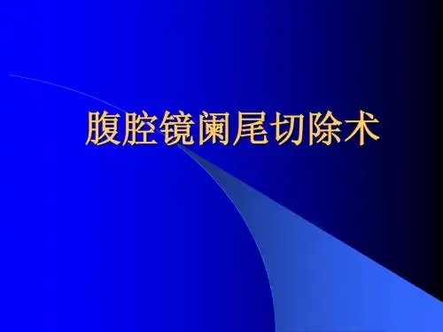 腹腔镜阑尾切除术