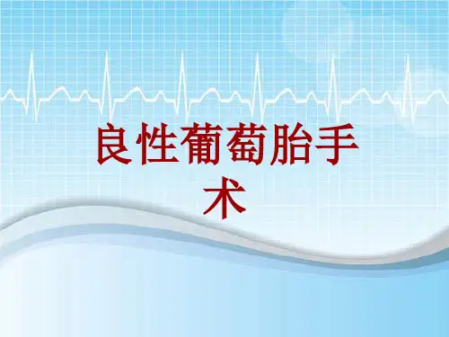 手术讲解模板：良性葡萄胎手术