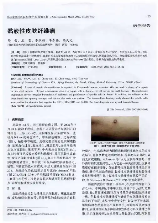 黏液性皮肤纤维瘤