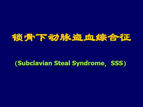 锁骨下动脉盗血