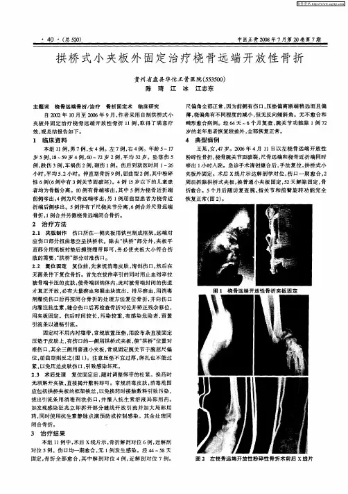 拱桥式小夹板外固定治疗桡骨远端开放性骨折