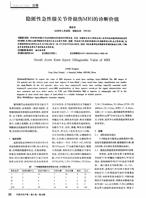 隐匿性急性膝关节骨损伤MRI的诊断价值
