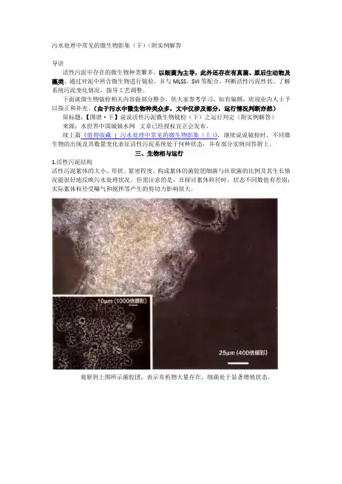 污水处理中常见的微生物影集2