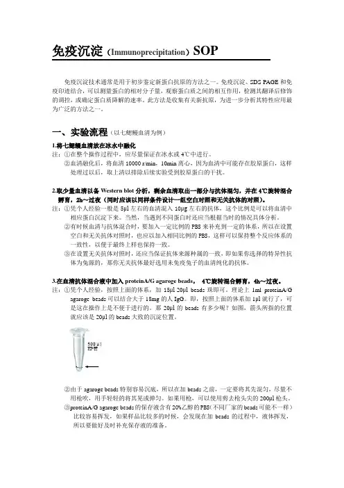 免疫沉淀SOP