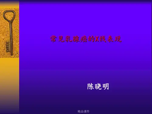 乳腺癌的常见钼靶表现