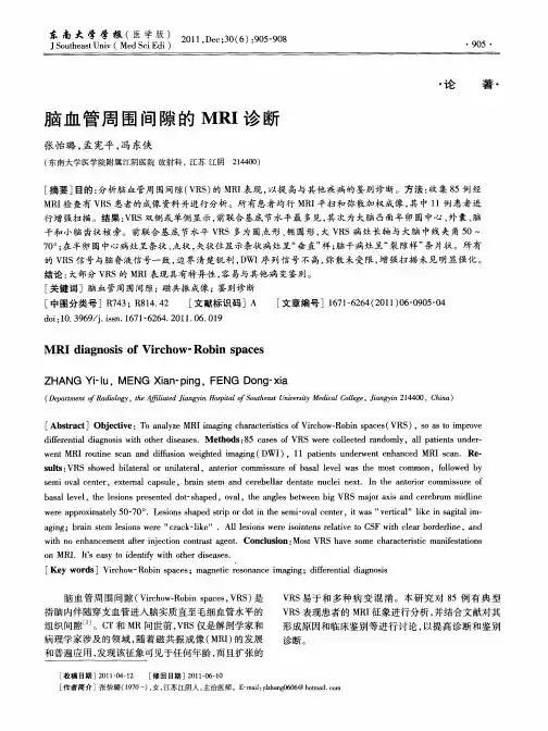 脑血管周围间隙的MRI诊断